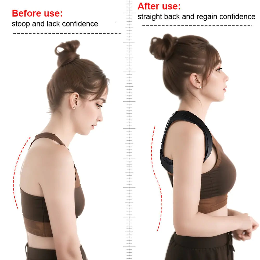 Order-Oasis™ Posture Corrector